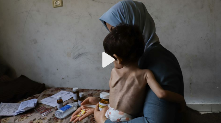 Anak sekarat karena kelaparan di pelukan orang tua mereka ketika kelaparan menyebar ke seluruh Gaza